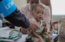 الكوليرا اليمن