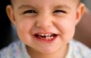 دراسة تكشف حقيقة الرابط بين الجينات وتسوس أسنان الأطفال