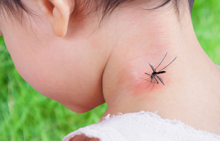 moustique-enfant-piqure-moustique-bebe-comment-proteger-enfant-piqure-moustique